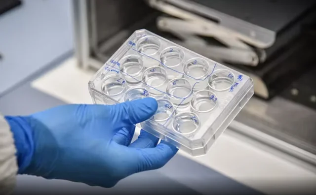  Tre “pap test”, asnjë nuk i zbuloi tumorin në mitër: 47-vjeçarja shqiptare humb jetën, familja dëmshpërblehet 300 mijë €