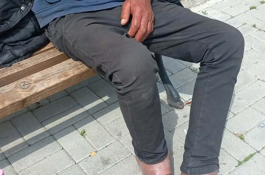  Në Vlorë, kujdesen më shumë për qentë se për njerëzit