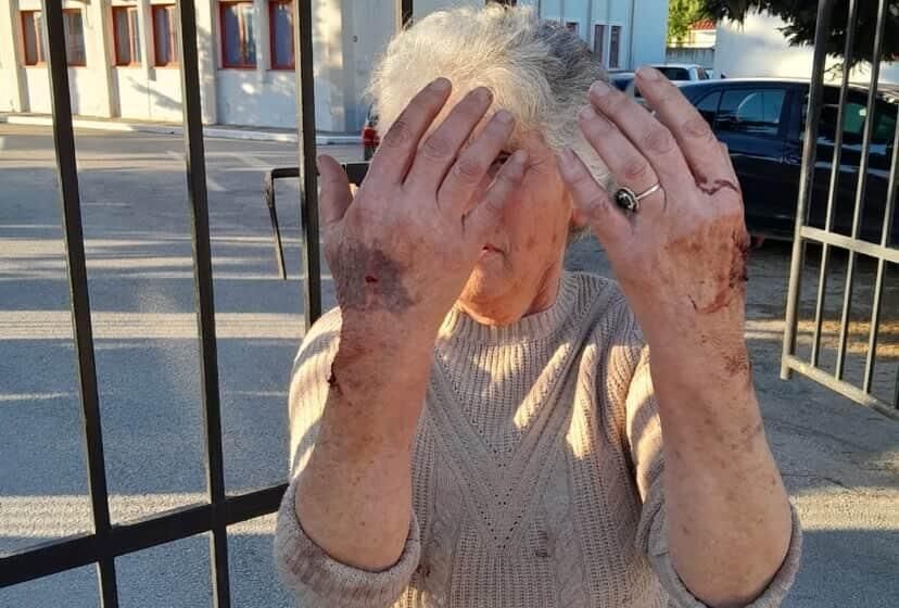  VIDEO/ Mafia e pronave dhunon të moshuarën dhe djalin e saj, policia shoqëron viktimën në vend që të ndalojë dhunuesit